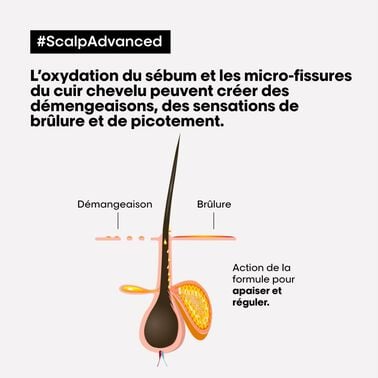 Scalp Advanced Shampoing dermo-régulateur - Scalp Advanced | L'Oréal Partner Shop